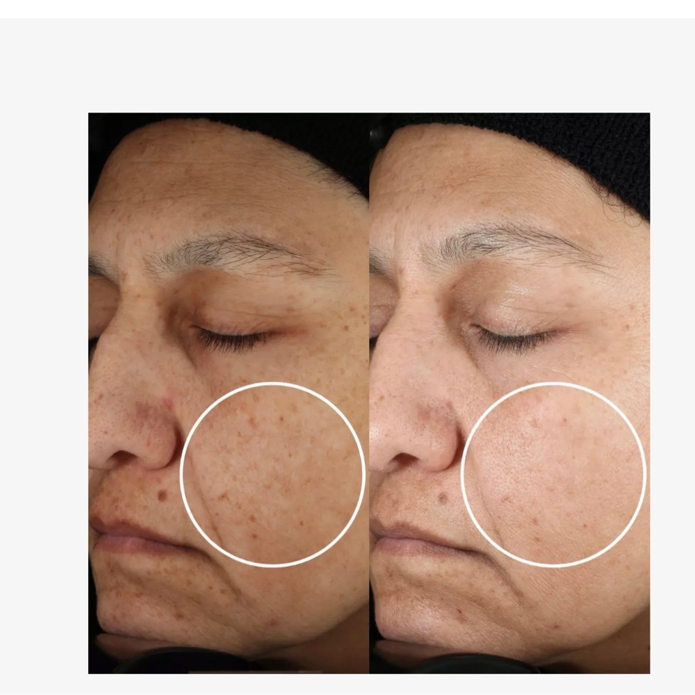 BeautyStat Universal C Skin Refiner - Picture 6 of 10